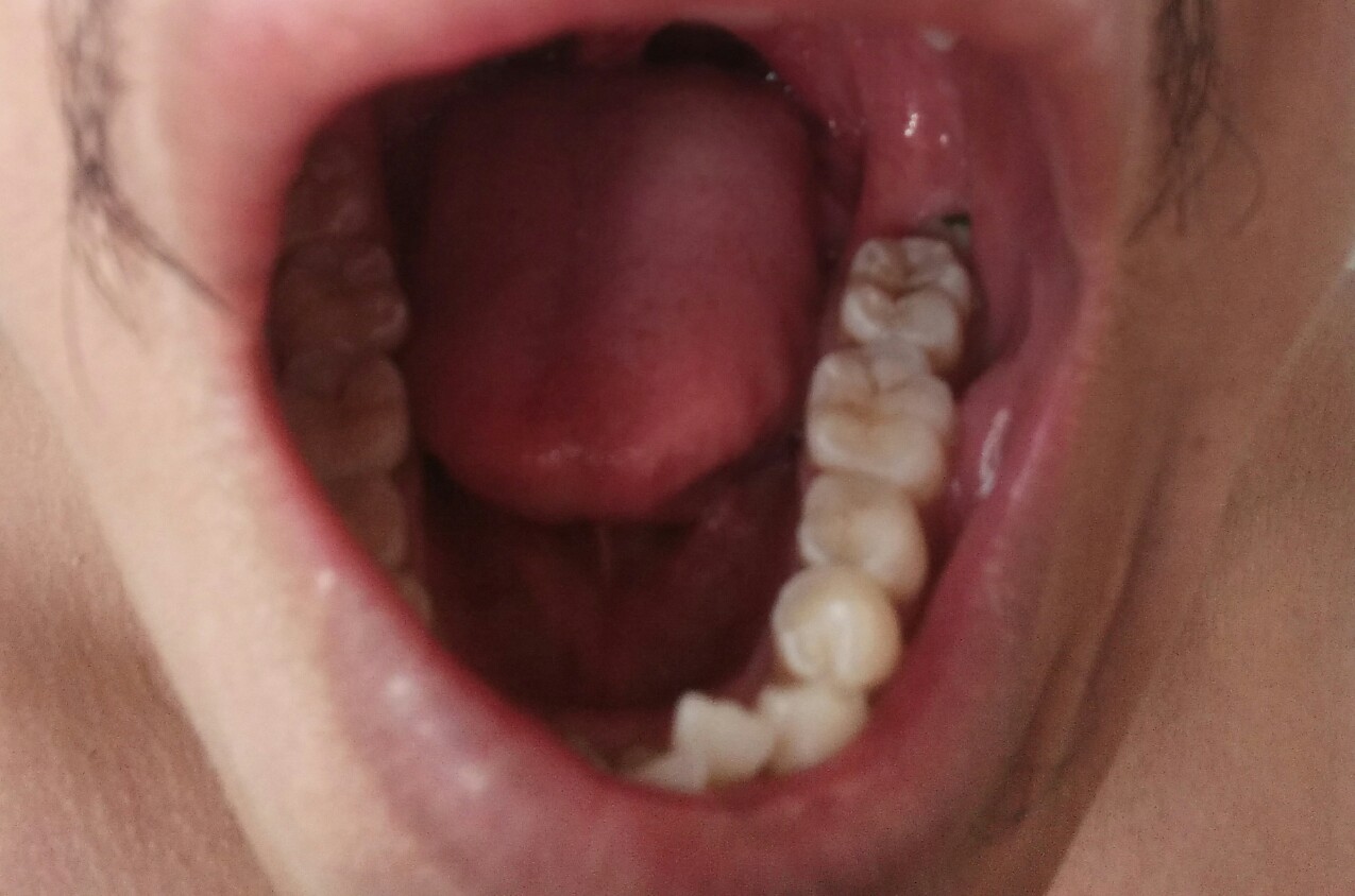 Img 20210802 142542 1