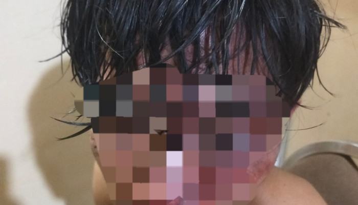 Ronda Malam Berubah Mencekam, Polisi Buru Pelaku Pengeroyokan Di Taman Sidoarjo