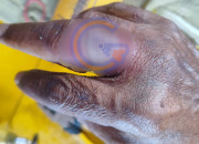 Jari Warga Terjepit Cincin, Tim Rescue BPBD Sidoarjo Lakukan Evakuasi Aman 8 20260804 075751 1